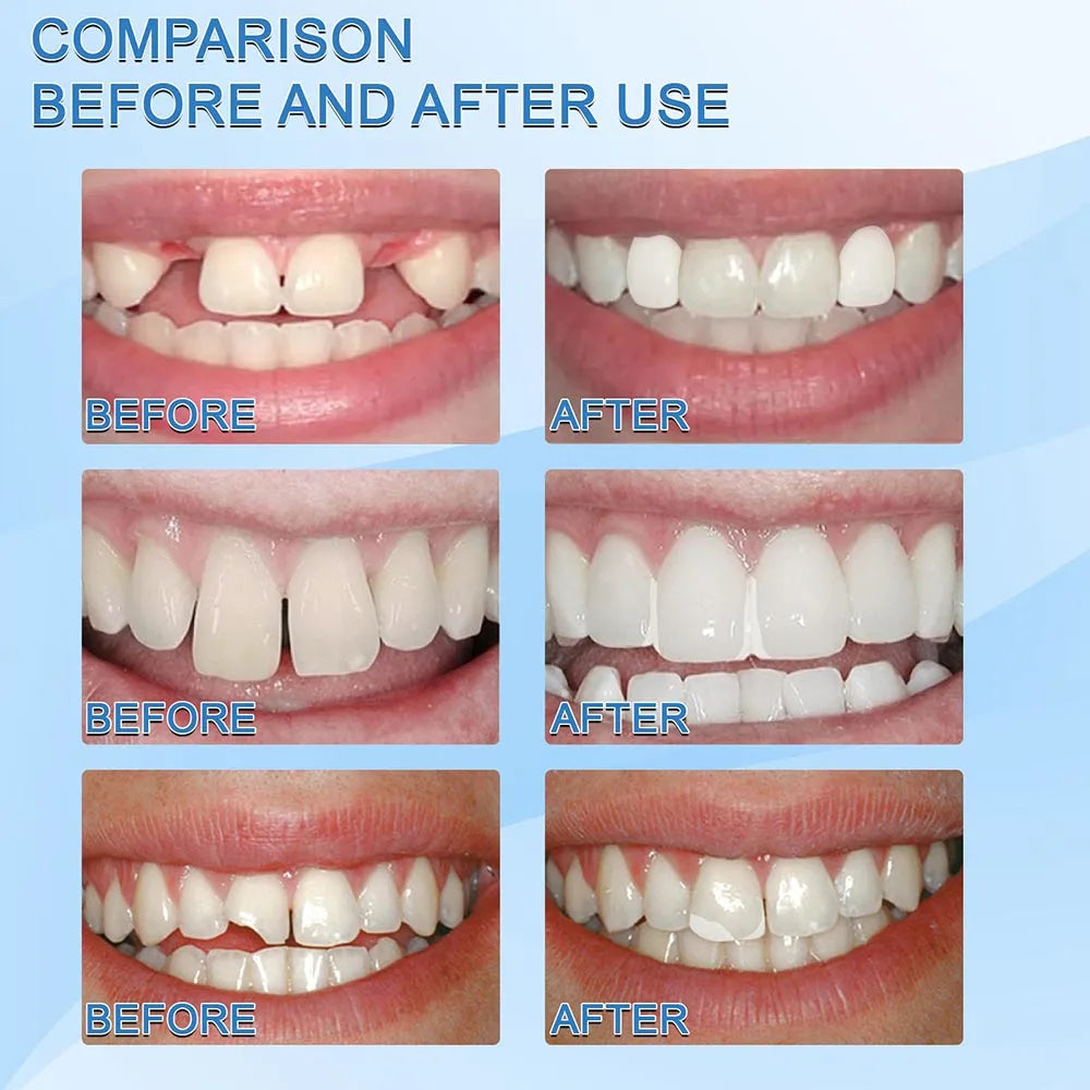 Gel Moldável Dentes Falsos